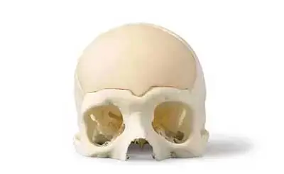 PSI Cranial Plate - Cranos