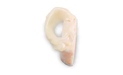 Meniscus