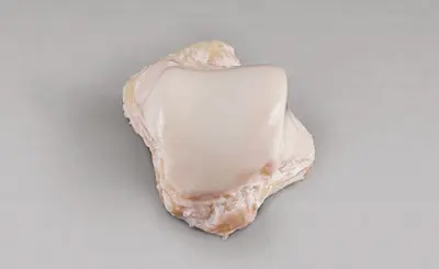 Talus