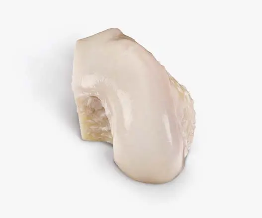 Osteochondral Allograft