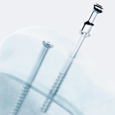 ActivaScrew absorbable fixation screw