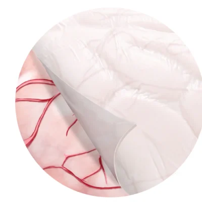 NeoDura absorbable dural repair patch, view 6