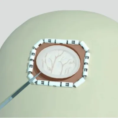 ReDura biomimetic dural repair patch, view 4