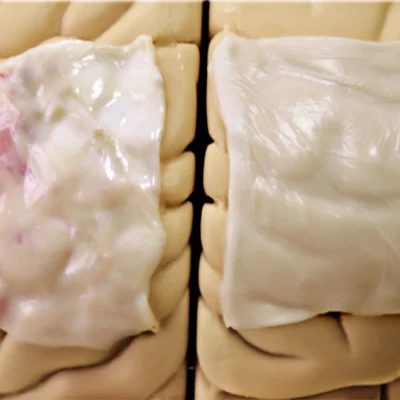 ReDura biomimetic dural repair patch, view 6