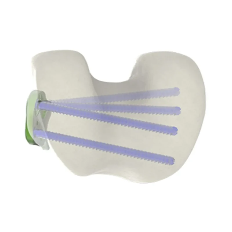 DFO Closing & Derotation plate