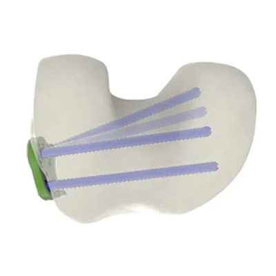 DFO Closing & Derotation plate