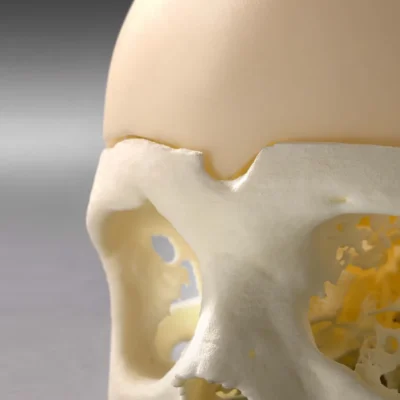 PSI Cranial Plate - Cranos